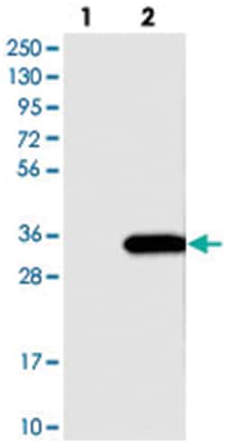 MRPL12, Rabbit, Polyclonal Antibody, Abnova 100 &mu;L | Buy Online | Abnova Corporation | Fisher Scientific