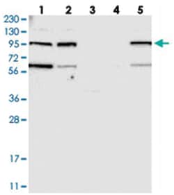 KIAA0753 Rabbit anti-Human, Polyclonal Antibody, Abnova 100 &mu;L | Buy Online | Abnova Corporation | Fisher Scientific