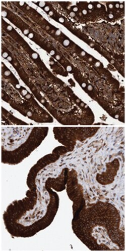 KIAA0753 Rabbit anti-Human, Polyclonal Antibody, Abnova 100 &mu;L | Buy Online | Abnova Corporation | Fisher Scientific