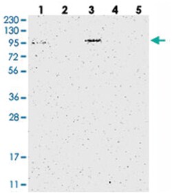 C17orf28, Rabbit, Polyclonal Antibody, Abnova 100 &mu;L | Buy Online | Abnova Corporation | Fisher Scientific