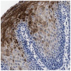 C17orf28, Rabbit, Polyclonal Antibody, Abnova 100 &mu;L | Buy Online | Abnova Corporation | Fisher Scientific