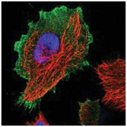 C17orf28, Rabbit, Polyclonal Antibody, Abnova 100 &mu;L | Buy Online | Abnova Corporation | Fisher Scientific