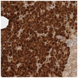 ZBTB2 Rabbit anti-Human, Polyclonal Antibody, Abnova 100 &mu;L | Buy Online | Abnova Corporation | Fisher Scientific