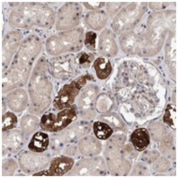 SLC45A4, Rabbit, Polyclonal Antibody, Abnova 100&mu;L; Unlabeled:Antibodies,