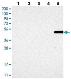 MFSD6L, Rabbit, Polyclonal Antibody, Abnova 100 &mu;L | Buy Online | Abnova | Fisher Scientific