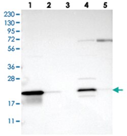 C8orf55, Rabbit, Polyclonal Antibody, Abnova 100 &mu;L | Buy Online | Abnova Corporation | Fisher Scientific