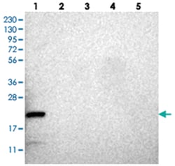 CCDC25, Rabbit, Polyclonal Antibody, Abnova 100 &mu;L | Buy Online | Abnova Corporation | Fisher Scientific