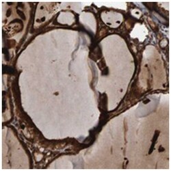 CCDC25, Rabbit, Polyclonal Antibody, Abnova 100 &mu;L | Buy Online | Abnova Corporation | Fisher Scientific