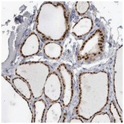 C17orf48 Rabbit anti-Human, Polyclonal Antibody, Abnova 100 &mu;L | Buy Online | Abnova Corporation | Fisher Scientific