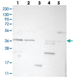 C17orf81, Rabbit, Polyclonal Antibody, Abnova 100&mu;L; Unlabeled:Antibodies,