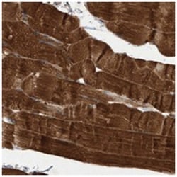 C17orf81, Rabbit, Polyclonal Antibody, Abnova 100&mu;L; Unlabeled:Antibodies,