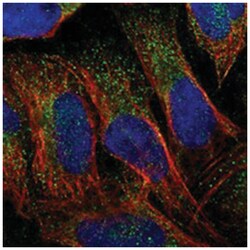 C17orf81, Rabbit, Polyclonal Antibody, Abnova 100&mu;L; Unlabeled:Antibodies,