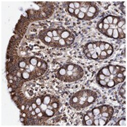 DSCR3 Rabbit anti-Human, Polyclonal Antibody, Abnova 100&mu;L; Unlabeled:Antibodies,