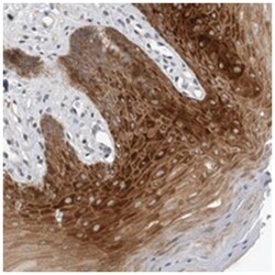 FAM83G Rabbit anti-Human, Polyclonal Antibody, Abnova 100 &mu;L | Buy Online | Abnova Corporation | Fisher Scientific