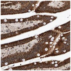 MRPL45 Rabbit anti-Human, Polyclonal Antibody, Abnova 100 &mu;L | Buy Online | Abnova Corporation | Fisher Scientific