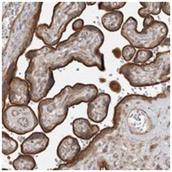 LRRC45 Rabbit anti-Human, Polyclonal Antibody, Abnova 100 &mu;L | Buy Online | Abnova Corporation | Fisher Scientific