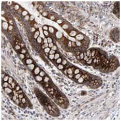 MRPL45 Rabbit anti-Human, Polyclonal Antibody, Abnova 100 &mu;L | Buy Online | Abnova Corporation | Fisher Scientific