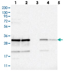 CCDC43, Rabbit, Polyclonal Antibody, Abnova 100 &mu;L | Buy Online | Abnova Corporation | Fisher Scientific