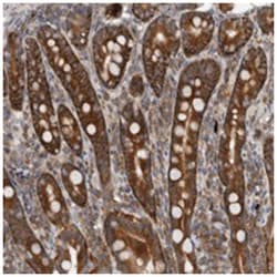 CCDC43, Rabbit, Polyclonal Antibody, Abnova 100 &mu;L | Buy Online | Abnova Corporation | Fisher Scientific