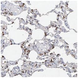 ZNF77, Rabbit, Polyclonal Antibody, Abnova 100 &mu;L | Buy Online | Abnova Corporation | Fisher Scientific