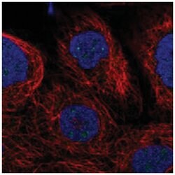 ZNF77, Rabbit, Polyclonal Antibody, Abnova 100 &mu;L | Buy Online | Abnova Corporation | Fisher Scientific