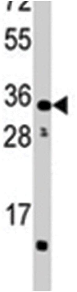 CTDSP2, Rabbit, Polyclonal Antibody, Abnova 400 &mu;L | Buy Online | Abnova Corporation | Fisher Scientific