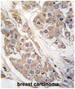 CTDSP2, Rabbit, Polyclonal Antibody, Abnova 400 &mu;L | Buy Online | Abnova Corporation | Fisher Scientific