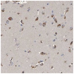 EFR3A Rabbit anti-Human, Polyclonal Antibody, Abnova 100 &mu;L | Buy Online | Abnova Corporation | Fisher Scientific