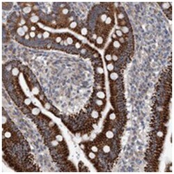 ZNF566, Rabbit, Polyclonal Antibody, Abnova 100&mu;L; Unlabeled:Antibodies,