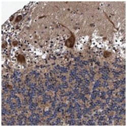 AGAP2 Rabbit anti-Human, Polyclonal Antibody, Abnova 100 &mu;L | Buy Online | Abnova Corporation | Fisher Scientific