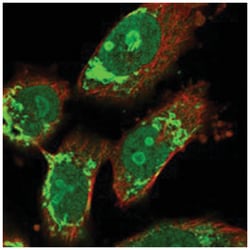 AGAP2 Rabbit anti-Human, Polyclonal Antibody, Abnova 100 &mu;L | Buy Online | Abnova Corporation | Fisher Scientific