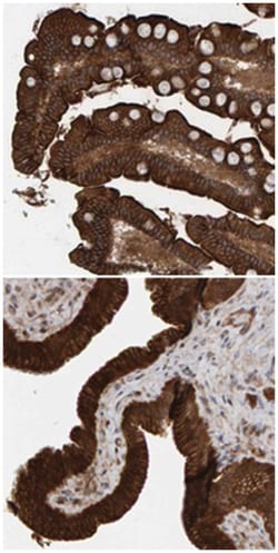 KIAA0753 Rabbit anti-Human, Polyclonal Antibody, Abnova 100μL; Unlabeled:Antibodies,