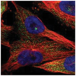 KIAA0753 Rabbit anti-Human, Polyclonal Antibody, Abnova 100μL; Unlabeled:Antibodies,