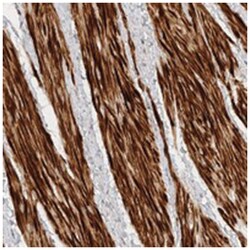 TTI2 Rabbit anti-Human, Polyclonal Antibody, Abnova 100 &mu;L | Buy Online | Abnova Corporation | Fisher Scientific