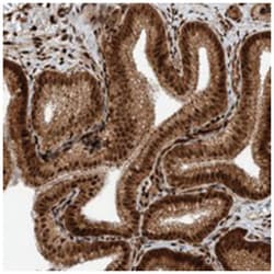 ZNF366 Rabbit anti-Human, Polyclonal Antibody, Abnova 100 &mu;L | Buy Online | Abnova Corporation | Fisher Scientific