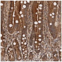 EFCAB1, Rabbit, Polyclonal Antibody, Abnova 100 &mu;L | Buy Online | Abnova | Fisher Scientific