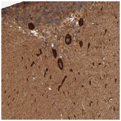 AP1GBP1 Rabbit anti-Human, Polyclonal Antibody, Abnova 100 &mu;L | Buy Online | Abnova Corporation | Fisher Scientific