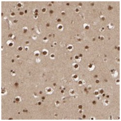 AP1GBP1 Rabbit anti-Human, Polyclonal Antibody, Abnova 100 &mu;L | Buy Online | Abnova Corporation | Fisher Scientific