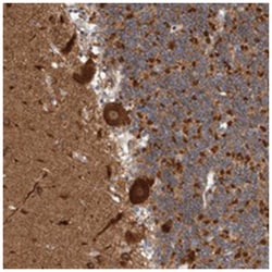 MSL1 Rabbit anti-Human, Polyclonal Antibody, Abnova 100 &mu;L | Buy Online | Abnova | Fisher Scientific