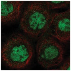 MSL1 Rabbit anti-Human, Polyclonal Antibody, Abnova 100 &mu;L | Buy Online | Abnova | Fisher Scientific
