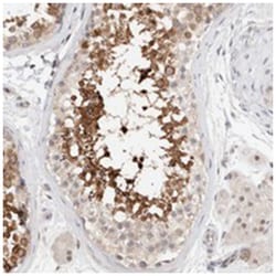 C17orf97, Rabbit, Polyclonal Antibody, Abnova 100&mu;L; Unlabeled:Antibodies,