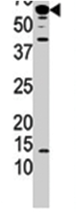 PPP3CA Rabbit anti-Human, Polyclonal Antibody, Abnova 400&mu;L; Unlabeled:Antibodies,