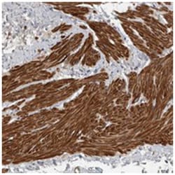 C11orf48 Rabbit anti-Human, Polyclonal Antibody, Abnova 100 &mu;L | Buy Online | Abnova Corporation | Fisher Scientific