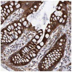 LRBA Rabbit anti-Human, Polyclonal Antibody, Abnova 100 &mu;L | Buy Online | Abnova Corporation | Fisher Scientific