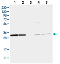 TATDN1, Rabbit, Polyclonal Antibody, Abnova 100 &mu;L | Buy Online | Abnova Corporation | Fisher Scientific