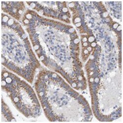 ZC3H3, Rabbit, Polyclonal Antibody, Abnova 100 &mu;L | Buy Online | Abnova Corporation | Fisher Scientific