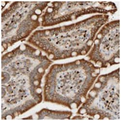 FMO1, Rabbit, Polyclonal Antibody, Abnova 100 &mu;L | Buy Online | Abnova Corporation | Fisher Scientific