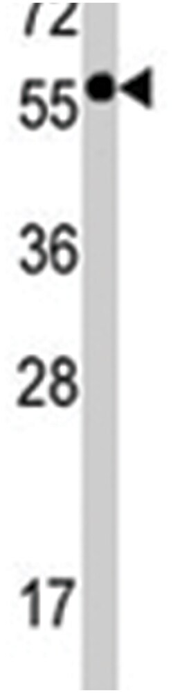 PPP3CB, Rabbit, Polyclonal Antibody, Abnova 400 &mu;L | Buy Online | Abnova Corporation | Fisher Scientific