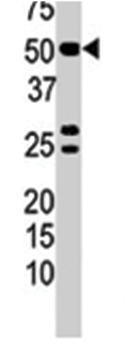 PPP3CB, Rabbit, Polyclonal Antibody, Abnova 400 &mu;L | Buy Online | Abnova Corporation | Fisher Scientific