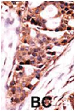 PPP3CB, Rabbit, Polyclonal Antibody, Abnova 400 &mu;L | Buy Online | Abnova Corporation | Fisher Scientific